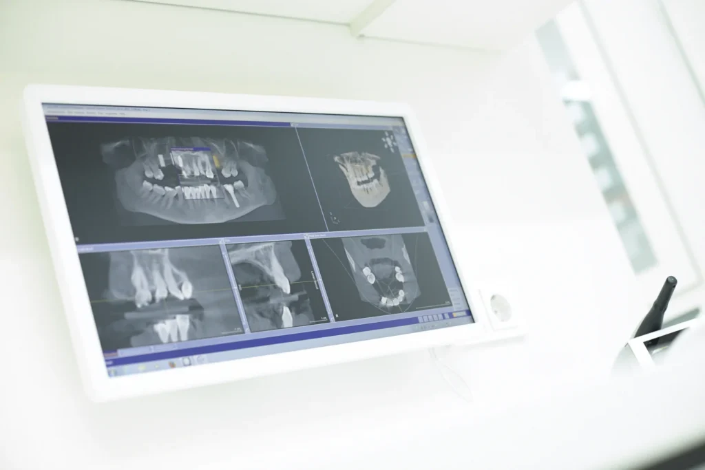 Digitales DVT-Röntgen in der Praxis Holtkamp