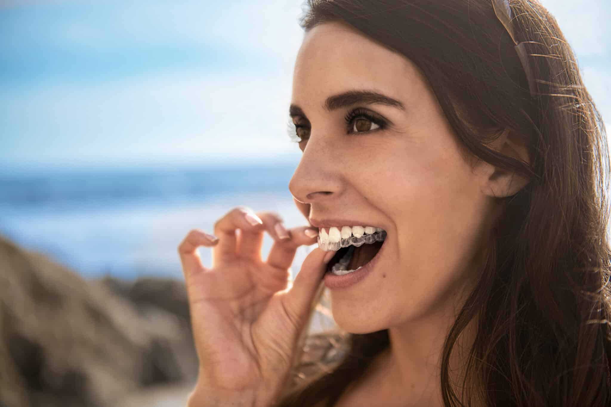 Lächelnde Person mit transparenten Invisalign-Alignern